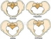 platypelloid pelvis / #269369